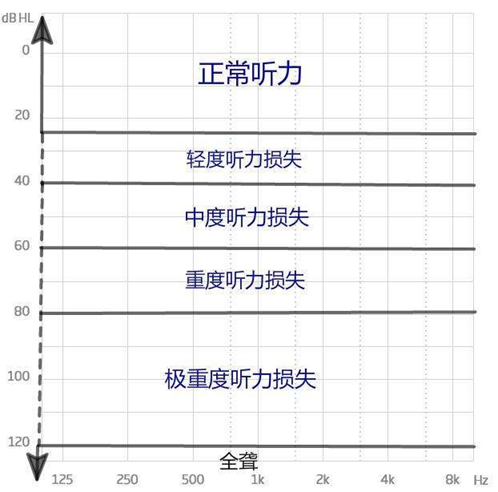 听力损失等级.jpg