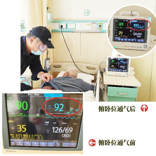 俯卧位通气.jpg